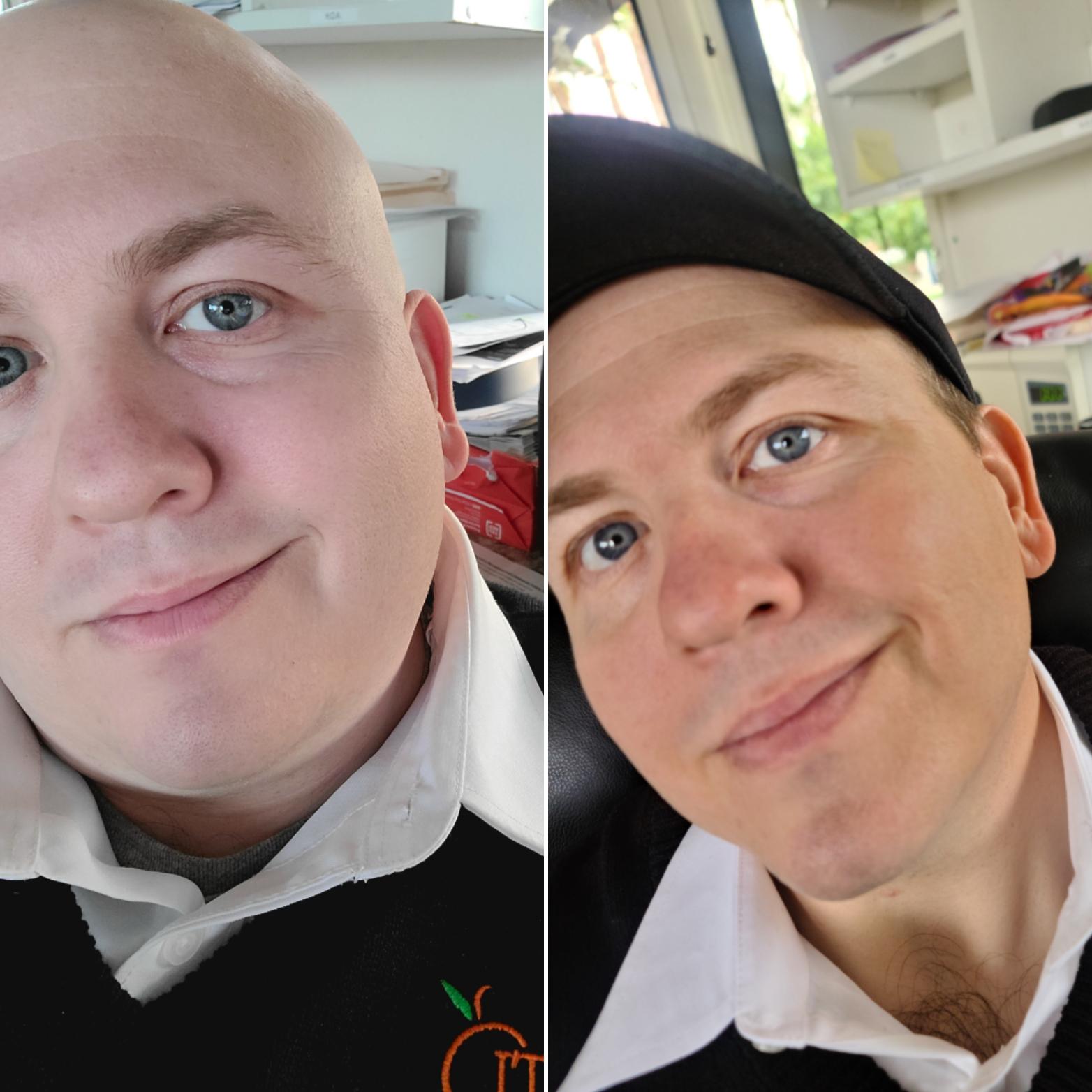Progress Pics of 137 lbs Fat Loss 5'7 Male 330 lbs to 193 lbs