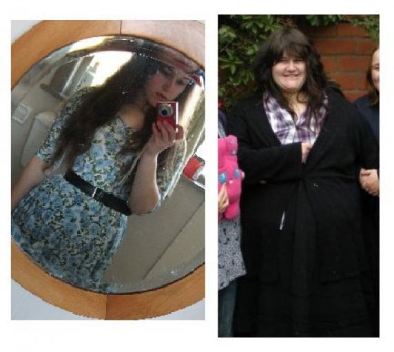 A before and after photo of a 5'5" female showing a weight loss from 370 pounds to 160 pounds. A net loss of 210 pounds.