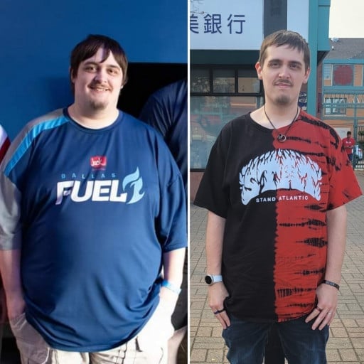 A before and after photo of a 6'0" male showing a weight reduction from 397 pounds to 197 pounds. A total loss of 200 pounds.