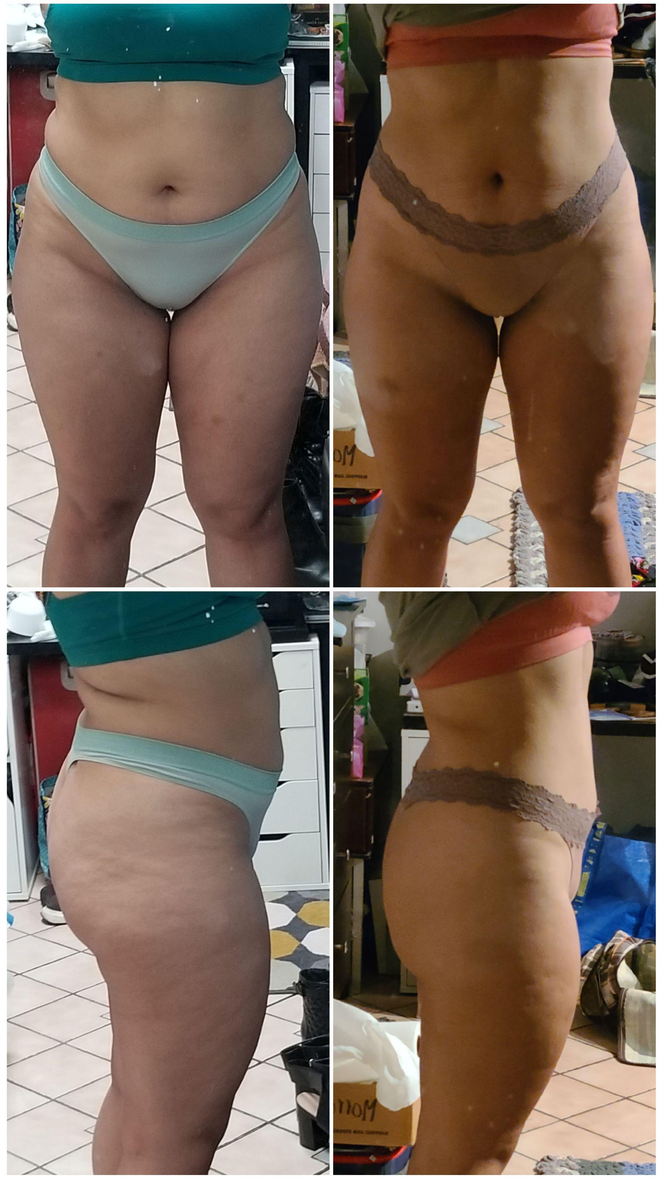 5 feet 5 Female Before and After 10 lbs Weight Loss 190 lbs to 180 lbs