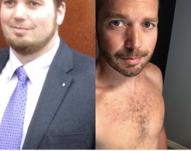 A progress pic of a 5'10" man showing a fat loss from 241 pounds to 171 pounds. A net loss of 70 pounds.