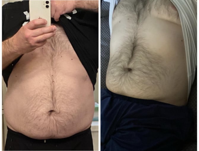 A progress pic of a person at 207 lbs