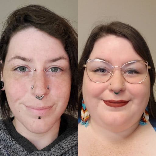 F/30/5'7 [398>188 = 210 Lbs] (36 Months) Face Gains Achieved Through Wls, Reduced Caloric Intake, and Steadily Increasing Exercise
Woman Loses 210 Pounds in 36 Months, Sees Drastic Change in Face