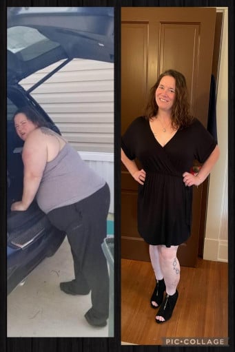 A progress pic of a 5'3" woman showing a fat loss from 301 pounds to 150 pounds. A net loss of 151 pounds.