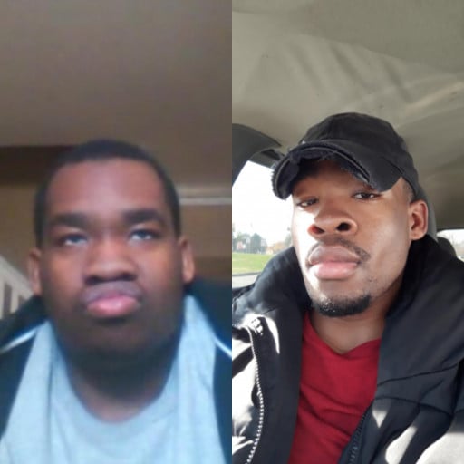 Before and After 95 lbs Fat Loss 5 foot 10 Male 300 lbs to 205 lbs